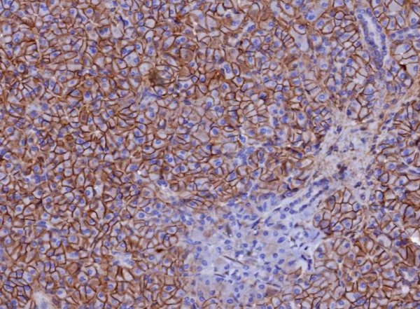 Formalin-fixed, paraffin-embedded human pancreas stained with  CD99 Mouse Monoclonal Antibody (MIC2/7867). HIER: Tris/EDTA, pH9.0, 45min. 2°C: HRP-polymer, 30min. DAB, 5min.