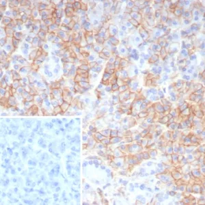 Formalin-fixed, paraffin-embedded human pancreas stained with  CD99 Recombinant Mouse Monoclonal Antibody (rMIC2/6939). Inset: PBS instead of primary antibody; secondary only negative control.
