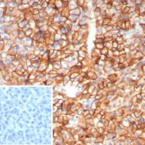 Formalin-fixed, paraffin-embedded human pancreas stained with  CD99 Recombinant Rabbit Monoclonal Antibody (MIC2/8119R). Inset: PBS instead of primary antibody; secondary only negative control.