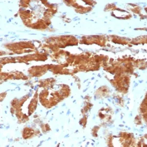 Formalin-fixed, paraffin-embedded human prostate stained with MIF Mouse Monoclonal Antibody (MIF/6282). HIER: Tris/EDTA, pH9.0, 45min. 2°C: HRP-polymer, 30min. DAB, 5min.