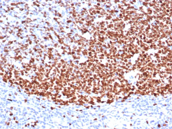 Formalin-fixed, paraffin-embedded human tonsil stained with Ki67 Mouse Monoclonal Antibody (MKI67/6571). HIER: Tris/EDTA, pH9.0, 45min. 2°C: HRP-polymer, 30min. DAB, 5min.
