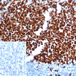 Formalin-fixed, paraffin-embedded human tonsil stained with Ki67-Monospecific Mouse Monoclonal Antibody (MKI67/6582). Inset: PBS instead of primary antibody; secondary only negative control.