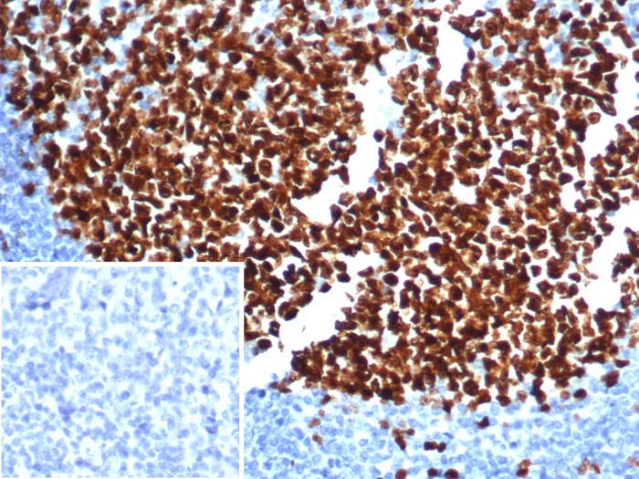 Ki67 (Proliferating Cell Marker) Antibody Clone MKI67/6582 Gene ID