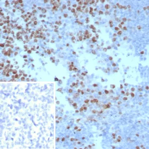 Formalin-fixed, paraffin-embedded human tonsil stained with Ki67 Mouse Monoclonal Antibody (MKI67/8743). Inset: PBS instead of primary antibody; secondary only negative control.