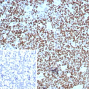 Formalin-fixed, paraffin-embedded human tonsil stained with Ki67 Recombinant Mouse Monoclonal Antibody (rMKI67/8852). Inset: PBS instead of primary antibody; secondary only negative control.