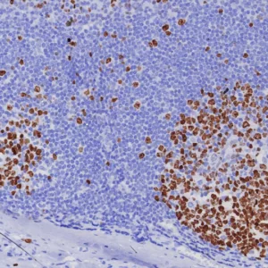 Formalin-fixed, paraffin-embedded human tonsil stained with Ki67 Recombinant Rabbit Monoclonal Antibody (MKI67/8005R). HIER: Tris/EDTA, pH9.0, 45min. 2: HRP-polymer, 30min. DAB, 5min.