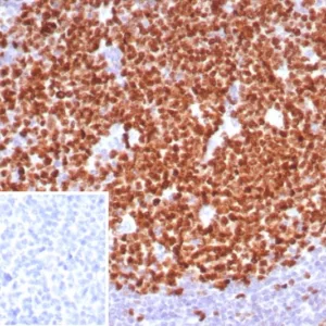 Formalin-fixed, paraffin-embedded human tonsil stained with Ki67 Recombinant Rabbit Monoclonal Antibody (MKI67/8315R). Inset: PBS instead of primary antibody; secondary only negative control.