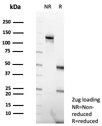 SDS-PAGE Analysis of Purified MLH1 Mouse Monoclonal Antibody (MLH1/7563). Confirmation of Purity and Integrity of Antibody.