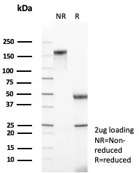SDS-PAGE Analysis of Purified NR3C2 Mouse Monoclonal Antibody (NR3C2/4900) Confirmation of Purity and Integrity of Antibody.