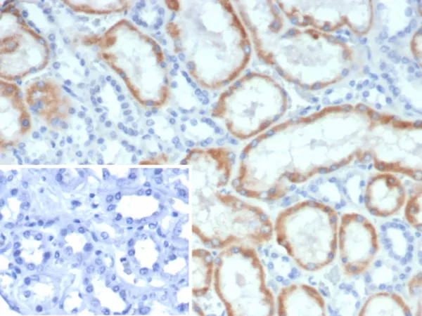 Formalin-fixed, paraffin-embedded human kidney stained with NR3C2 Mouse Monoclonal Antibody (NR3C2/4900). Inset: PBS instead of primary antibody; secondary only negative control.