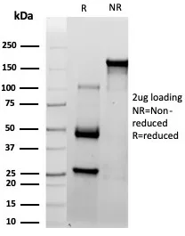 SDS-PAGE Analysis of Purified CD10 Mouse Monoclonal Antibody (MME/4237). Confirmation of Purity and Integrity of Antibody. CD10 (Membrane Metalloendopeptidase) Antibody - Image 2