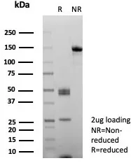 SDS-PAGE Analysis  Purified CD10 Recombinant Mouse Monoclonal Antibody (rMME/8584). Confirmation of Integrity and Purity of Antibody.