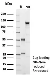 SDS-PAGE Analysis of Purified CD10 Recombinant Mouse Monoclonal Antibody (rMME/9377). Confirmation of Purity and Integrity of Antibody.