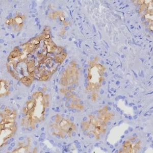 Formalin-fixed, paraffin-embedded human kidney stained with CD10 Recombinant Rabbit Monoclonal Antibody (MME/8376R). HIER: Tris/EDTA, pH9.0, 45min. 2: HRP-polymer, 30min. DAB, 5min.