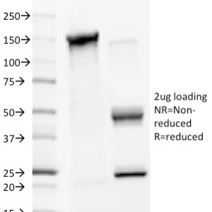 SDS-PAGE Analysis of Purified MMP2 Mouse Monoclonal Antibody (4D3). Confirmation of Integrity and Purity of Antibody.
