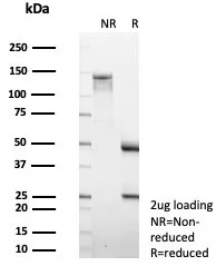 SDS-PAGE Analysis of Purified MMP2 Mouse Monoclonal Antibody (MMP2/4586). Confirmation of Integrity and Purity of Antibody.