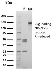 SDS-PAGE Analysis of Purified MPZ Mouse Monoclonal Antibody (MPZ/7389). Confirmation of Purity and Integrity of Antibody.