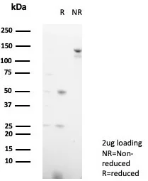 SDS-PAGE Analysis of Purified MPZ Mouse Monoclonal Antibody (MPZ/7390). Confirmation of Purity and Integrity of Antibody.
