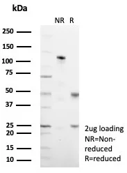 SDS-PAGE Analysis of Purified MUC1 Recombinant Rabbit Monoclonal Antibody (MUC1/7797R). Confirmation of Purity and Integrity of Antibody.