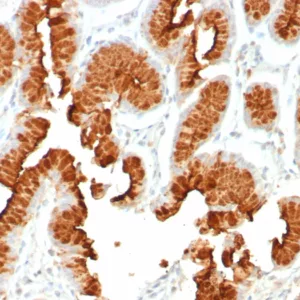 Formalin-fixed, paraffin-embedded human stomach stained with MUC5AC Recombinant Mouse Monoclonal (rMUC5AC/8052) at 2ug/ml. HIER: Tris/EDTA, pH9.0, 45min. 2°C: HRP-polymer, 30min. DAB, 5min.