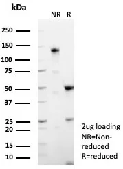 SDS-PAGE Analysis of Purified MUC5AC Recombinant Rabbit Monoclonal (MUC5AC/7798R). Confirmation of Purity and Integrity of Antibody.