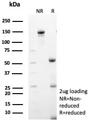 SDS-PAGE Analysis  Purified MX1 Mouse Monoclonal Antibody (MX1/7527). Confirmation of Purity and Integrity of Antibody.