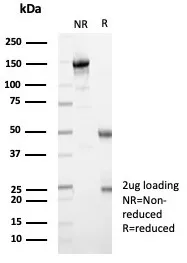 SDS-PAGE Analysis  Purified MX1 Mouse Monoclonal Antibody (MX1/7529). Confirmation of Purity and Integrity of Antibody.