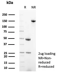 SDS-PAGE Analysis  Purified MX1 Mouse Monoclonal Antibody (MX1/7530). Confirmation of Purity and Integrity of Antibody.