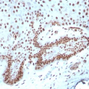 Formalin-fixed, paraffin-embedded human cervix stained with c-Myc Recombinant Rabbit Monoclonal Antibody (MYC/7854R). HIER: Tris/EDTA, pH9.0, 45min. 2°C: HRP-polymer, 30min. DAB, 5min.