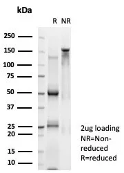 SDS-PAGE Analysis  Purified n-Myc Mouse Monoclonal Antibody (PCRP-MYCN-1A9). Confirmation of Purity and Integrity of Antibody.