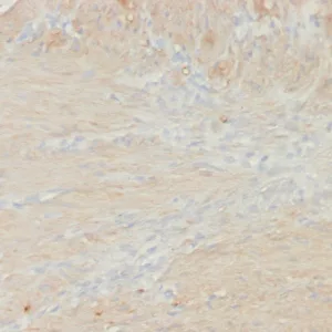 Formalin-fixed, paraffin-embedded colon smooth muscle stained with SM-MHC Recombinant Mouse Monoclonal Antibody (rMYH11/8066). HIER: Tris/EDTA, pH9.0, 45min. 2°C: HRP-polymer, 30min. DAB, 5min.