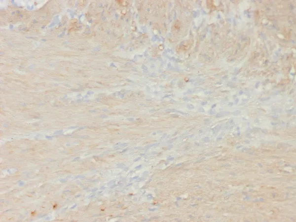 Formalin-fixed, paraffin-embedded colon smooth muscle stained with SM-MHC Recombinant Mouse Monoclonal Antibody (rMYH11/8066). HIER: Tris/EDTA, pH9.0, 45min. 2°C: HRP-polymer, 30min. DAB, 5min.
