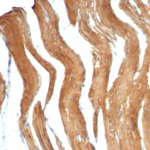 Formalin-fixed, paraffin-embedded human smooth muscle stained with SM-MHC Recombinant Rabbit Monoclonal Antibody (MYH11/7610R). HIER: Tris/EDTA, pH9.0, 45min. 2°C: HRP-polymer, 30min. DAB, 5min.