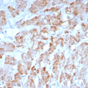 Formalin-fixed, paraffin-embedded human smooth muscle stained with SM-MHC Recombinant Rabbit Monoclonal Antibody (MYH11/8185R). HIER: Tris/EDTA, pH9.0, 45min. 2°C: HRP-polymer, 30min. DAB, 5min.