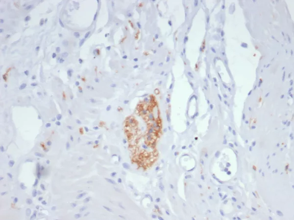 Formalin-fixed, paraffin-embedded human colon stained with CD56 Mouse Monoclonal Antibody (NCAM/7521). HIER: Tris/EDTA, pH9.0, 45min. 2°C: HRP-polymer, 30min. DAB, 5min.