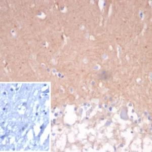 Formalin-fixed, paraffin-embedded human cerebellum stained with CD56 Mouse Monoclonal Antibody (NCAM/7524). Inset: PBS instead of primary antibody; secondary only negative control.