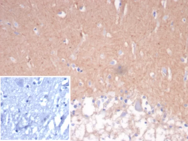 Formalin-fixed, paraffin-embedded human cerebellum stained with CD56 Mouse Monoclonal Antibody (NCAM/7524). Inset: PBS instead of primary antibody; secondary only negative control.