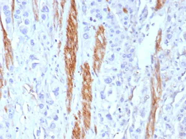 Formalin-fixed, paraffin-embedded human colon stained with CD56 Recombinant Mouse Monoclonal Antibody (rNCAM1/8580). HIER: Tris/EDTA, pH9.0, 45min. 2°C: HRP-polymer, 30min. DAB, 5min.