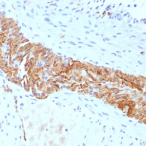 Formalin-fixed, paraffin-embedded human colon stained with CD56 Recombinant Mouse Monoclonal Antibody (rNCAM1/8655). HIER: Tris/EDTA, pH9.0, 45min. 2°C: HRP-polymer, 30min. DAB, 5min.