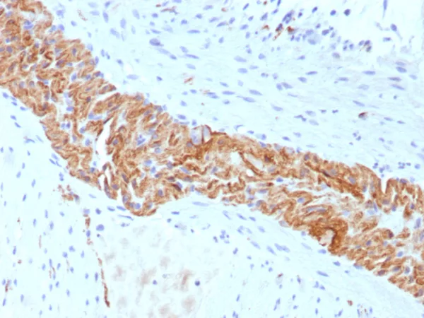 Formalin-fixed, paraffin-embedded human colon stained with CD56 Recombinant Mouse Monoclonal Antibody (rNCAM1/8655). HIER: Tris/EDTA, pH9.0, 45min. 2°C: HRP-polymer, 30min. DAB, 5min.