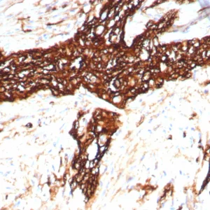 Formalin-fixed, paraffin-embedded human colon stained with CD56 Recombinant Mouse Monoclonal Antibody (rNCAM1/8758). HIER: Tris/EDTA, pH9.0, 45min. 2°C: HRP-polymer, 30min. DAB, 5min.
