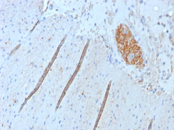 Formalin-fixed, paraffin-embedded human colon stained with CD56 Rabbit Recombinant Monoclonal Antibody (NCAM1/8392R). HIER: Tris/EDTA, pH9.0, 45min. 2°C: HRP-polymer, 30min. DAB, 5min.