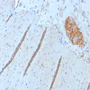 Formalin-fixed, paraffin-embedded human colon stained with CD56 Rabbit Recombinant Monoclonal Antibody (NCAM1/9074R). HIER: Tris/EDTA, pH9.0, 45min. 2°C: HRP-polymer, 30min. DAB, 5min.