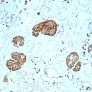 Formalin-fixed, paraffin-embedded human colon stained with CD56 Rabbit Recombinant Monoclonal Antibody (NCAM1/9121R). HIER: Tris/EDTA, pH9.0, 45min. 2°C: HRP-polymer, 30min. DAB, 5min.