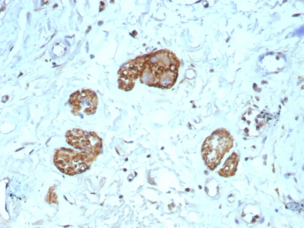 Formalin-fixed, paraffin-embedded human colon stained with CD56 Rabbit Recombinant Monoclonal Antibody (NCAM1/9121R). HIER: Tris/EDTA, pH9.0, 45min. 2°C: HRP-polymer, 30min. DAB, 5min.