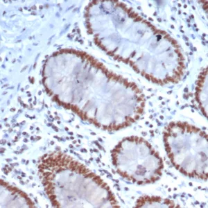 Formalin-fixed, paraffin-embedded human colon stained with Nucleolin Mouse Monoclonal Antibody (NCL/7337). HIER: Tris/EDTA, pH9.0, 45min. 2°C: HRP-polymer, 30min. DAB, 5min.
