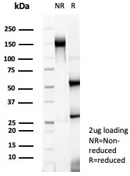 SDS-PAGE Analysis of Purified Nucleolin Recombinant Rabbit Monoclonal Antibody (NCL/8068R). Confirmation of Integrity and Purity of Antibody.