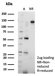 SDS-PAGE Analysis of Purified Nucleolin Recombinant Rabbit Monoclonal Antibody (NCL/8695R). Confirmation of Integrity and Purity of Antibody.
