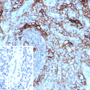 Formalin-fixed, paraffin-embedded human spleen stained with NGFR Rabbit Recombinant Monoclonal Antibody (NGFR/8590R). Inset: PBS instead of primary antibody; secondary only negative control.