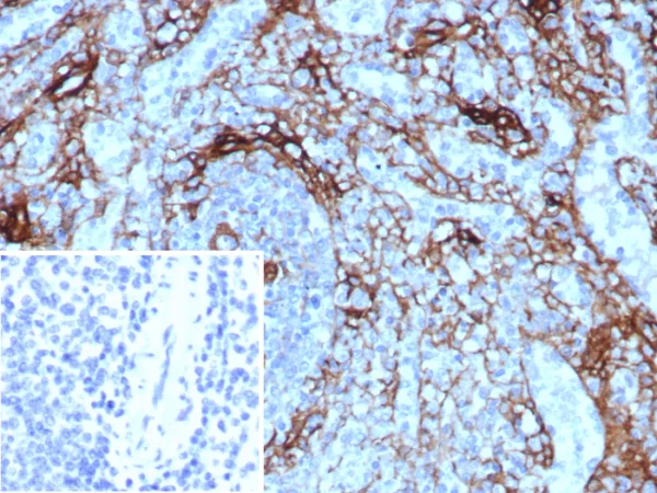 Formalin-fixed, paraffin-embedded human spleen stained with NGFR Rabbit Recombinant Monoclonal Antibody (NGFR/8590R). Inset: PBS instead of primary antibody; secondary only negative control.
